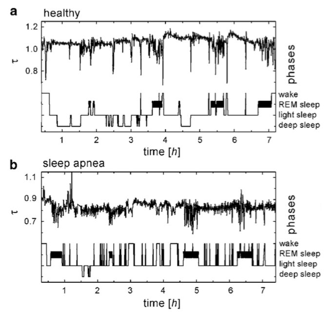 Sleep phases and HRV