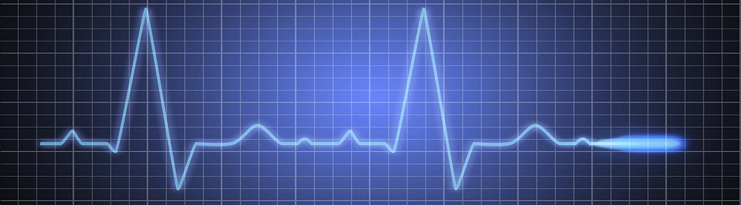 What is heart rate variability (HRV)?